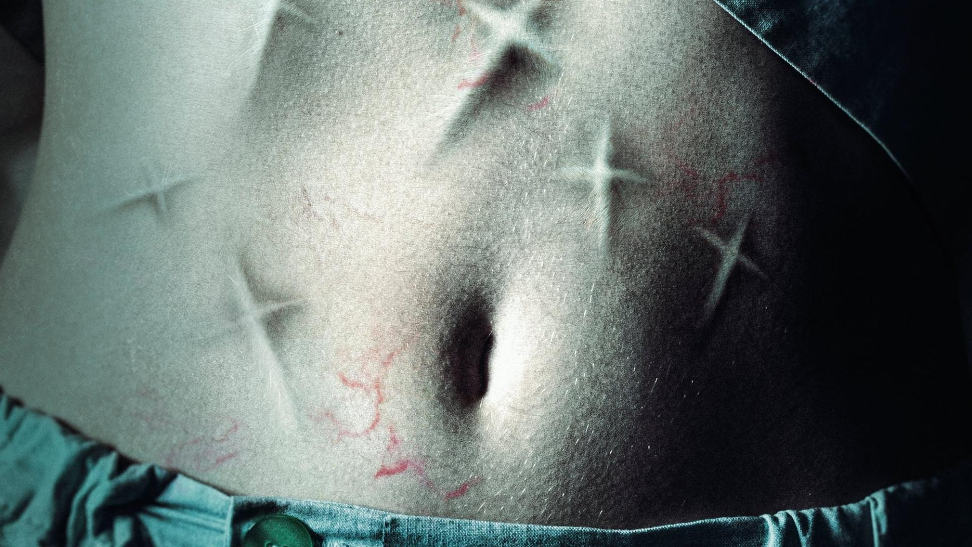 13 ეგზორციზმი / 13 exorcismos