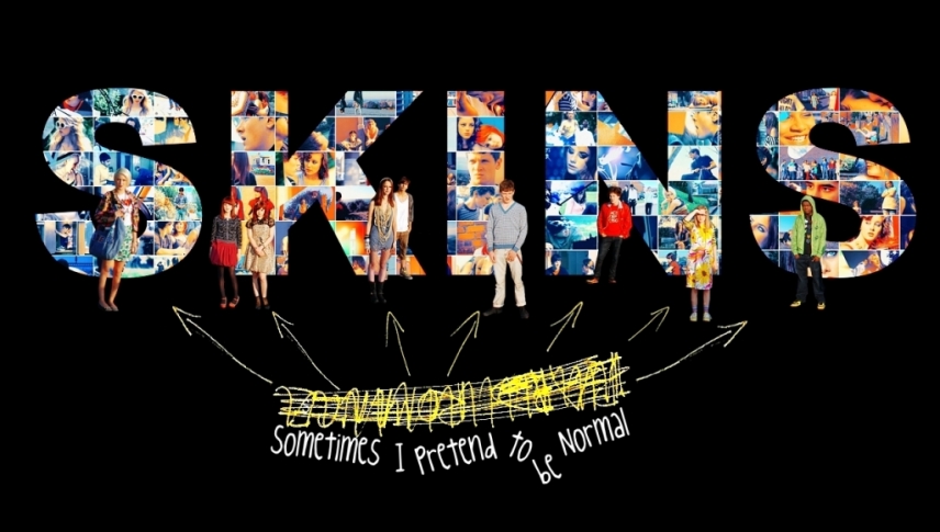 მოზარდები / Skins
