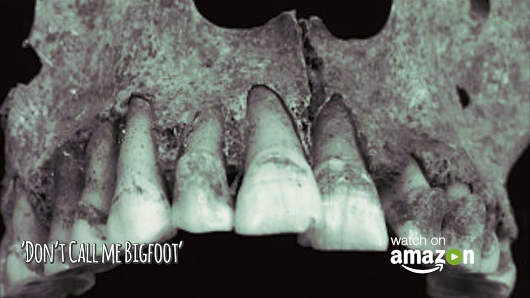 არ დამიძახო იეტი / Don't Call Me Bigfoot
